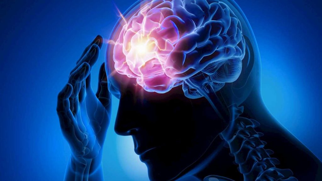 epilepsie